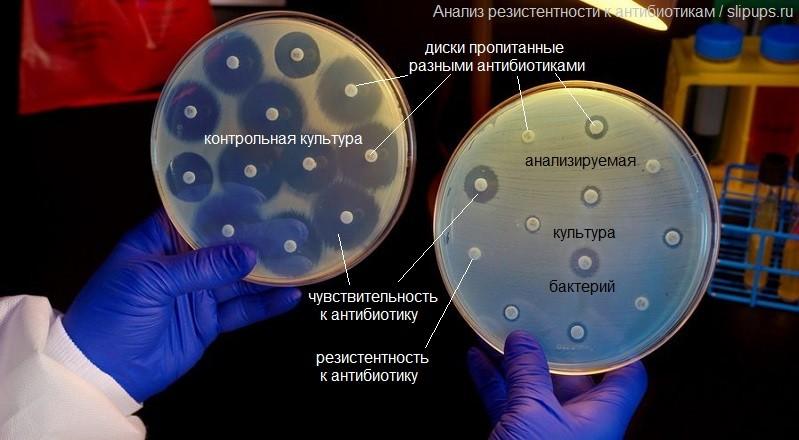 Резистентность (устойчивость к антибиотикам)